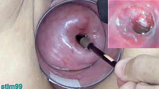 Older Milf Cervix Play with Endoscope Asian Web-cam into Uterus