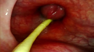 EXTREME ANAL SELF PERSPECTIVE. WEBCAM INSIDE HER ANUS AS I POUND HER WITH MY GIANT PENIS AND SPERM DEEP INSIDE