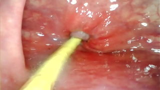 EXTREME ANAL POINT OF VIEW. WEBCAM INSIDE HER BUTT-HOLE AS I POUND HER WITH MY HUGE WANG AND JIZZ DEEP INSIDE